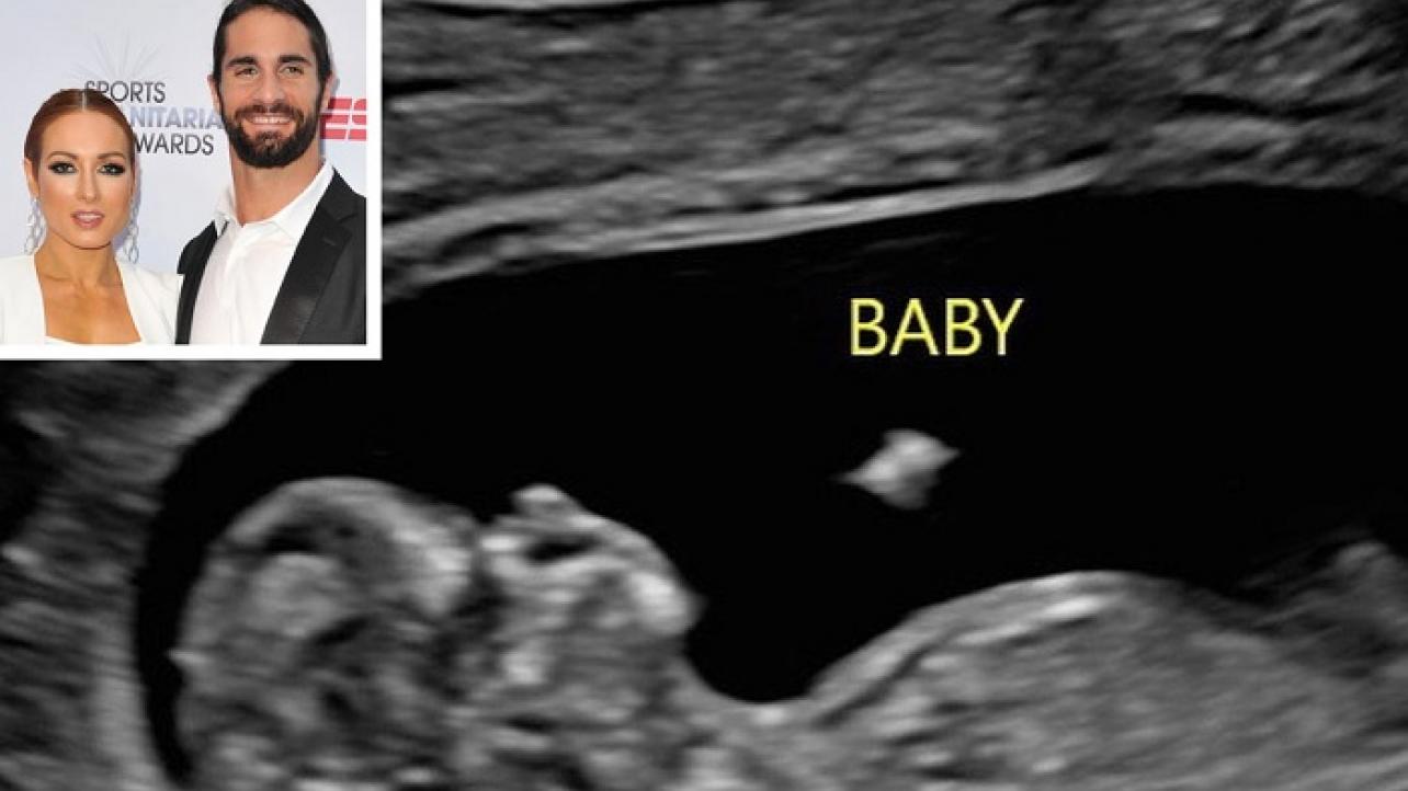 Irish WWE star Becky Lynch shares first ultrasound of new baby as