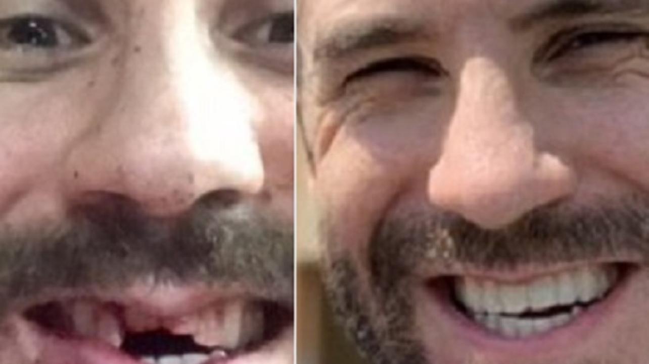 Before & After: Cesaro Gets Braces Removed 2 Years After Getting Teeth Knocked Out (Photos)