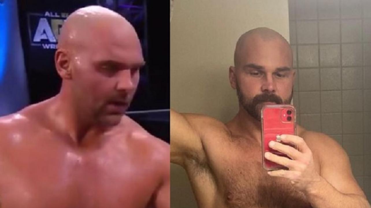 Dax Harwood Before & After Weight Gain (PHOTOS)