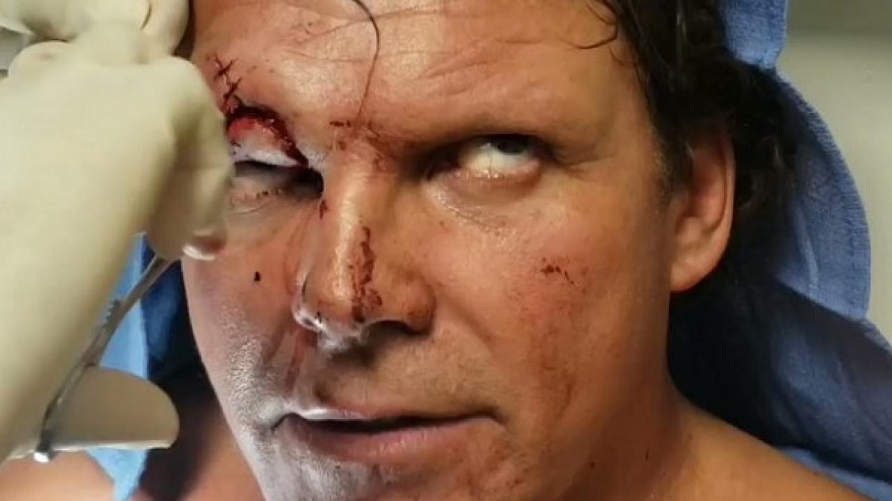 PCO Suffers Awful Eye Injury At ROH Atlanta Live Event (Videos & Photos)