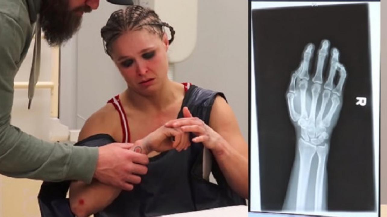 Ronda Rousey Goes Into Detail On How She Suffered Awful Finger Injury, X-Ray Photo