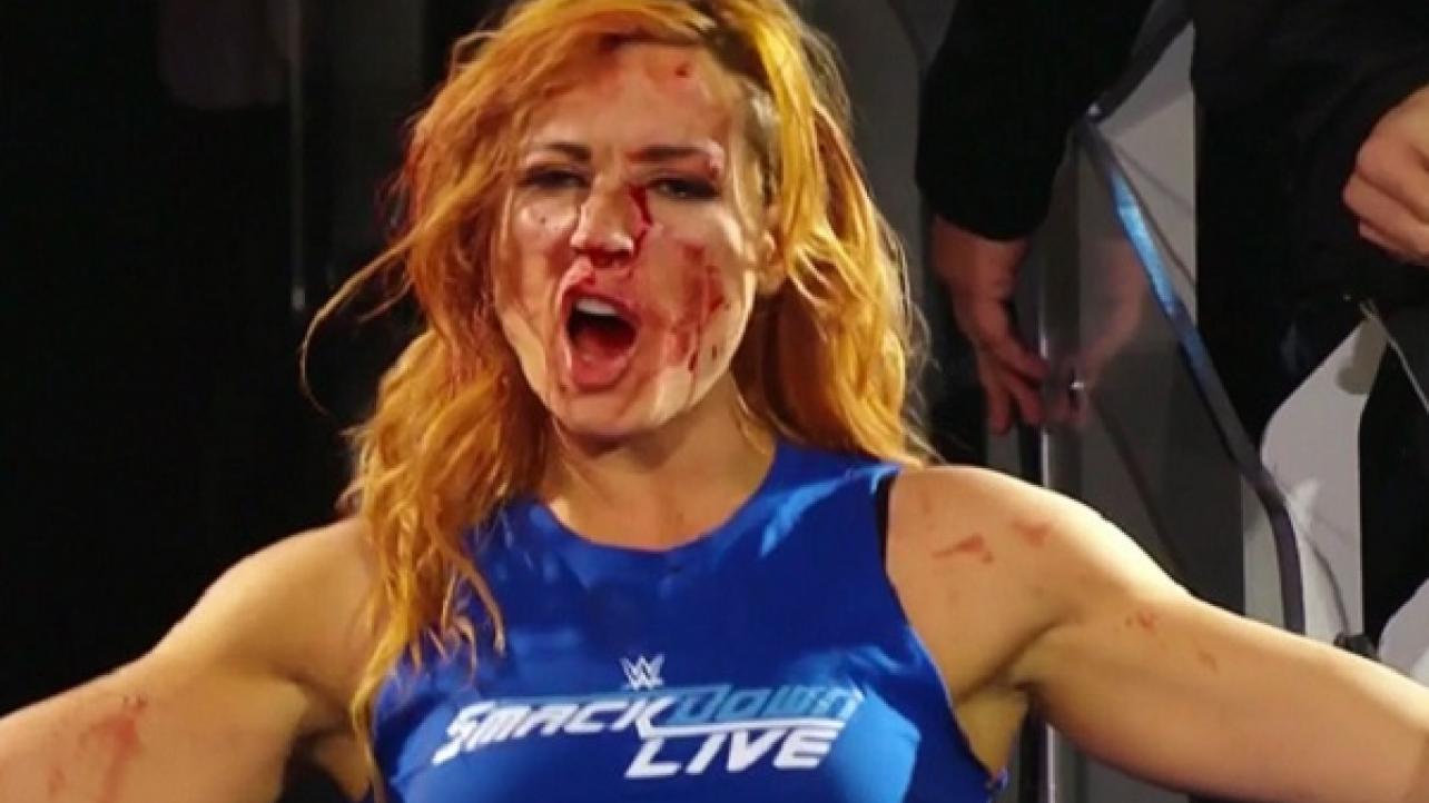 Watch Video Of Nia Jax Breaking Becky Lynch's Nose